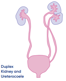 duplex-kidney.png
