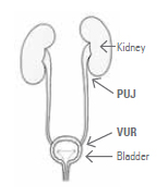 Baby—kidney pelvis dilatation - Patient Information Brochures - Mater Group